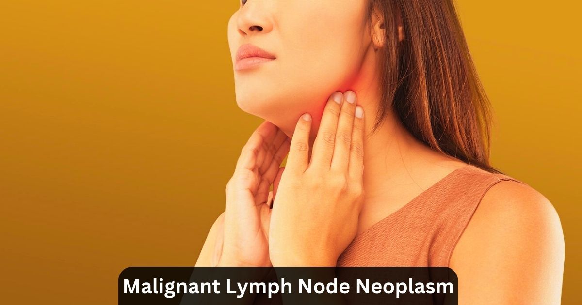 Malignant Lymph Node Neoplasm